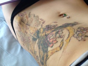 tattoo_removal1-jpg